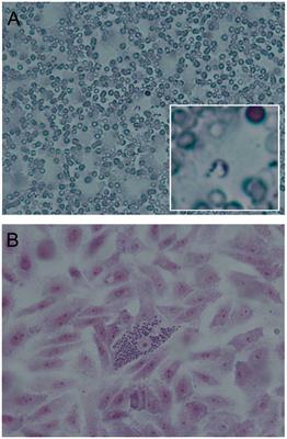 Laboratory diagnosis of Trypanosoma cruzi infection: a narrative review